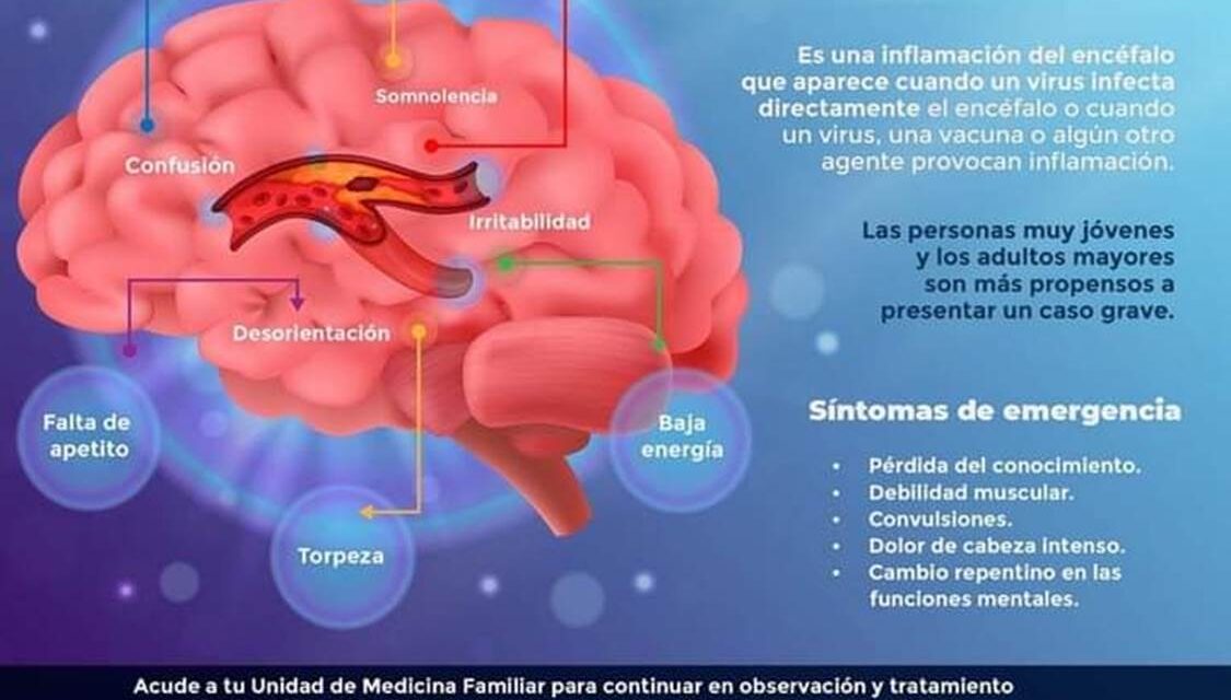 Orienta IMSS Veracruz Sur sobre síntomas y causas de encefalitis